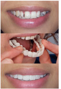 为什么有的人牙齿整齐有的人牙齿参差不呢 