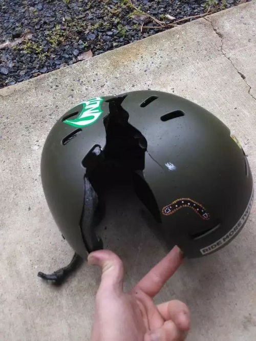 骑车为什么要戴头盔 看完网友分享的图片你就知道了...