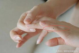 手指有痣有哪些命理意义 你的手指有痣吗 