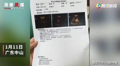 奇葩 广东一男子医院就诊被查出怀孕,自嘲要寻找孩子父亲,医院回应亮了