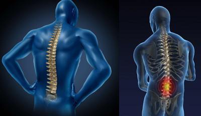 强直性脊椎炎的症状 强直性脊柱炎常见的症状有哪些