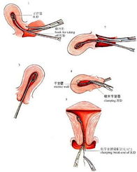 为什么不建议女人上环知乎