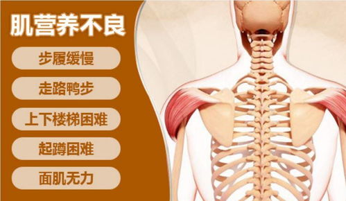 肌营养不良的表现都有哪些？