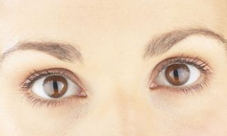 关于做双眼皮的危害 双眼皮修复