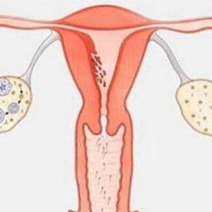 卵巢功能是可逆的吗？试管助孕能行吗？