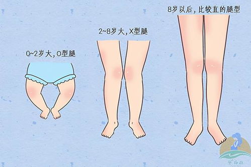 宝宝出现O型腿,不是纸尿裤的锅,这些传统方法,可能起到反效果