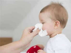 婴儿流鼻涕该怎么办