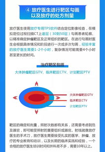 全国肿瘤防治宣传周 8个步骤读懂放疗全流程