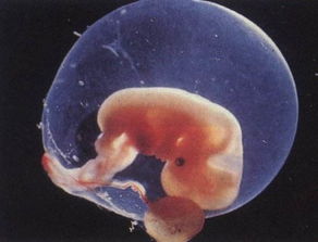 人类胚胎在母体任何地方都能存活吗