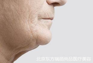 皮肤老化的原因皱纹产生的六大因素及除皱解决办法 