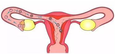 输卵管堵塞怎么办呢