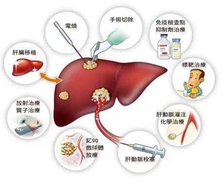 反复肩痛可能是大病前兆 身体这四种信号一出现,需要上医院