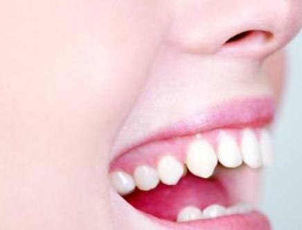 心理测试 三种牙齿,你觉得哪一种最可爱 测你最有福气的一面