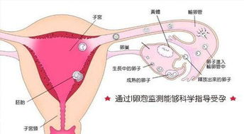 输卵管堵塞必须要做试管婴儿吗 该做什么检查