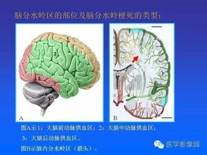 "；分水岭"；是什么意思呢?