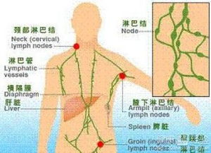 淋巴结核与淋巴结发炎有什么区别