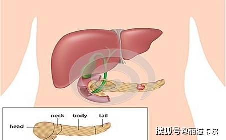 万癌之王 胰腺癌有这三个特点,预防该从何做起