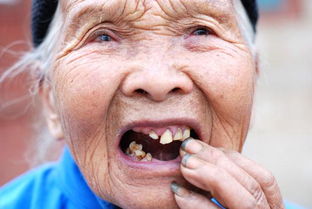 人多少岁掉牙才正常 老掉牙是自然规律