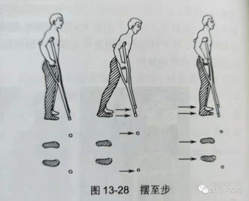 为什么瘫痪病人下肢恢复比上肢快