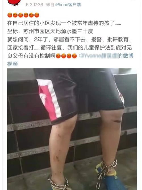 单亲父亲虐待不满十岁的儿子,戴着脚镣满腿伤痕,相关部门已介入调查