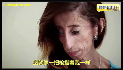 世界上最难看的女人视频大全（世界上最漂亮的人视频） 第1张