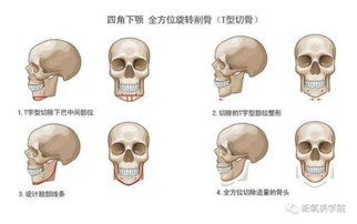 下巴后缩面相