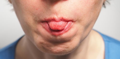 舌苔厚腻是什么原因 早上起床后,又觉得舌头发臭
