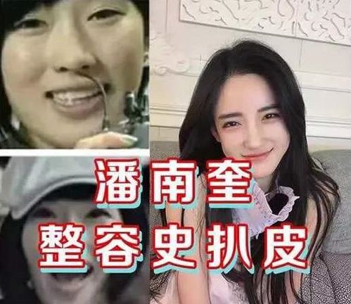 花10亿整成baby,出名就抢走闺蜜老公,被打后现状落魄