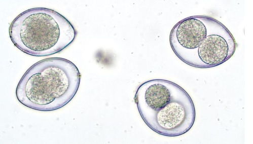 10张临床图片快速了解粪便细胞学的正常与异常