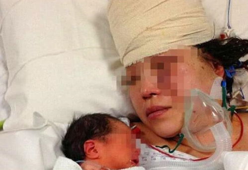 原创怀孕32周摔跤，孕妈一直昏迷不醒，把宝宝放到怀里发生感人一幕