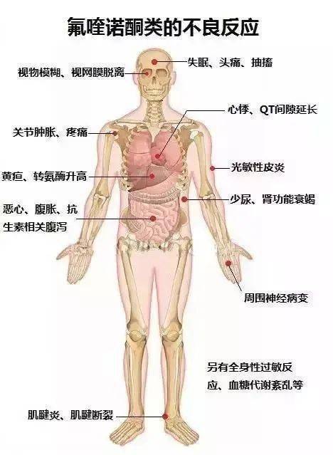 干货来袭 需要警惕的喹诺酮类药物