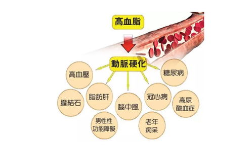 求助医生，我的体检结果说，血脂高，胆固醇5.85，怎么办？还有缺钾3.02，，，怎么解决啊？25岁