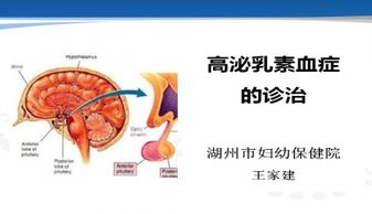 高泌乳素血症ppt下载