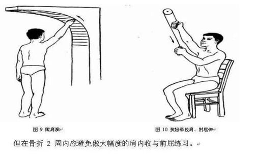 最全面骨科常见康复功能锻炼方法