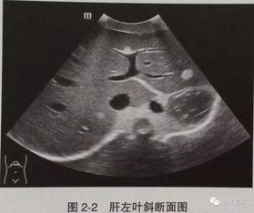 图颅腔矢状面 信息阅读欣赏 信息村 K0w0m Com