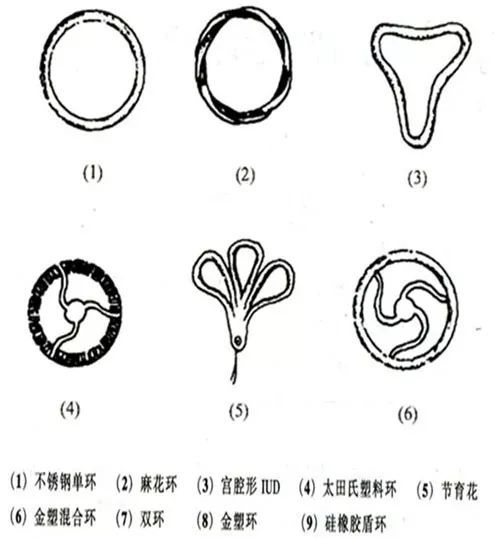 宫内节育器图片？宫形环是什么形状图片