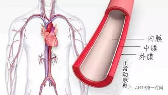 肥西一准妈妈突发胸背疼痛 医生说她体内藏 炸弹 主动脉随时会破 