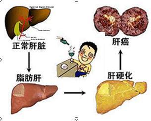 探究热成像内分泌免疫检查的必要性