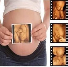 妊娠初期，怀孕初期有什么症状