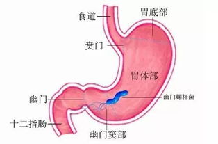 这种微生物不仅会传染还与胃癌有一定的关联,要早防早治