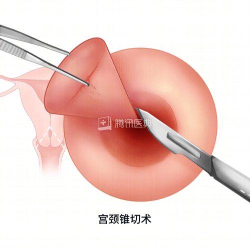 宫颈为何这么爱生病 女生最该了解的6个知识