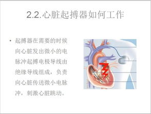 心脏起搏器小知识