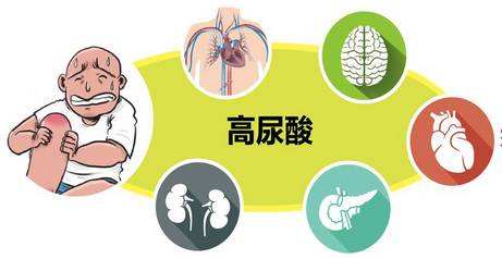 尿酸500,但不发作也不疼,需要治疗吗 一文告诉你高尿酸的危害