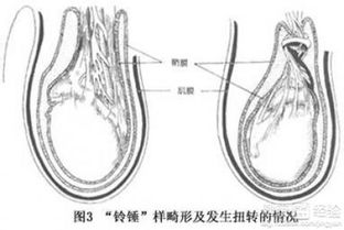 简易冷水浴疗法养护睾丸增强性能力