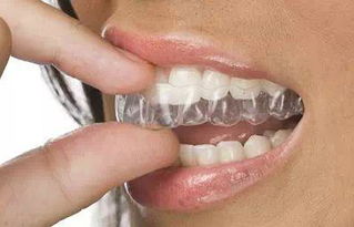 30岁 戴牙套应该注意什么
