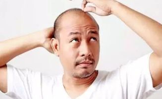 男人脱发谢顶是房事过频导致的吗(男人脱发秃顶是什么原因)