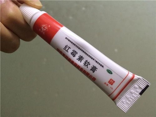 产后痔疮怎么快速治愈,这款痔疮膏绝了,帮你拯救菊花不复发