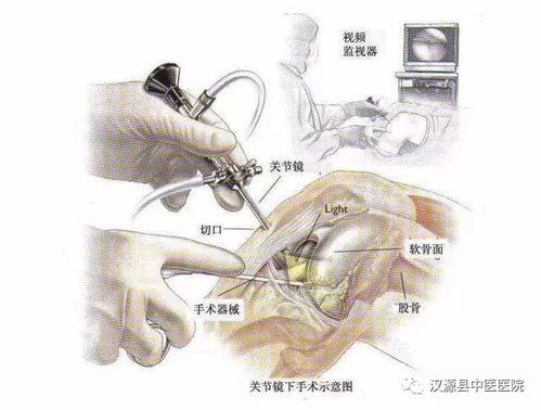 特色专科 关节疾病患者的福音 关节镜手术了解一下