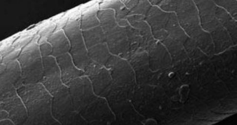 洗澡搓下来的黑泥是什么 黑泥在显微镜下放大到500倍,却是这样