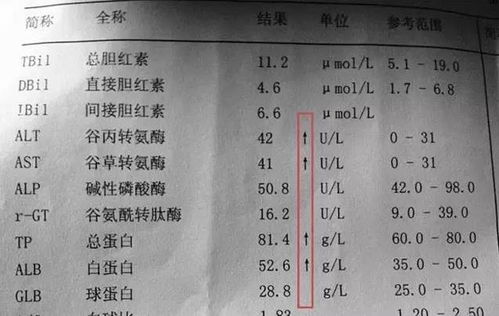 肝功能化验单，如何看懂肝功化验单